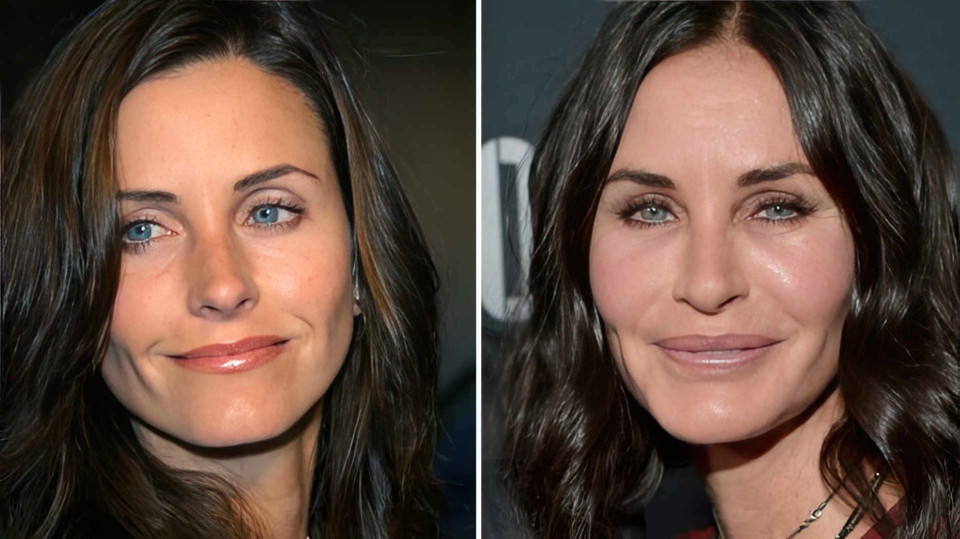 Courteney Cox prima e dopo la chirurgia plastica