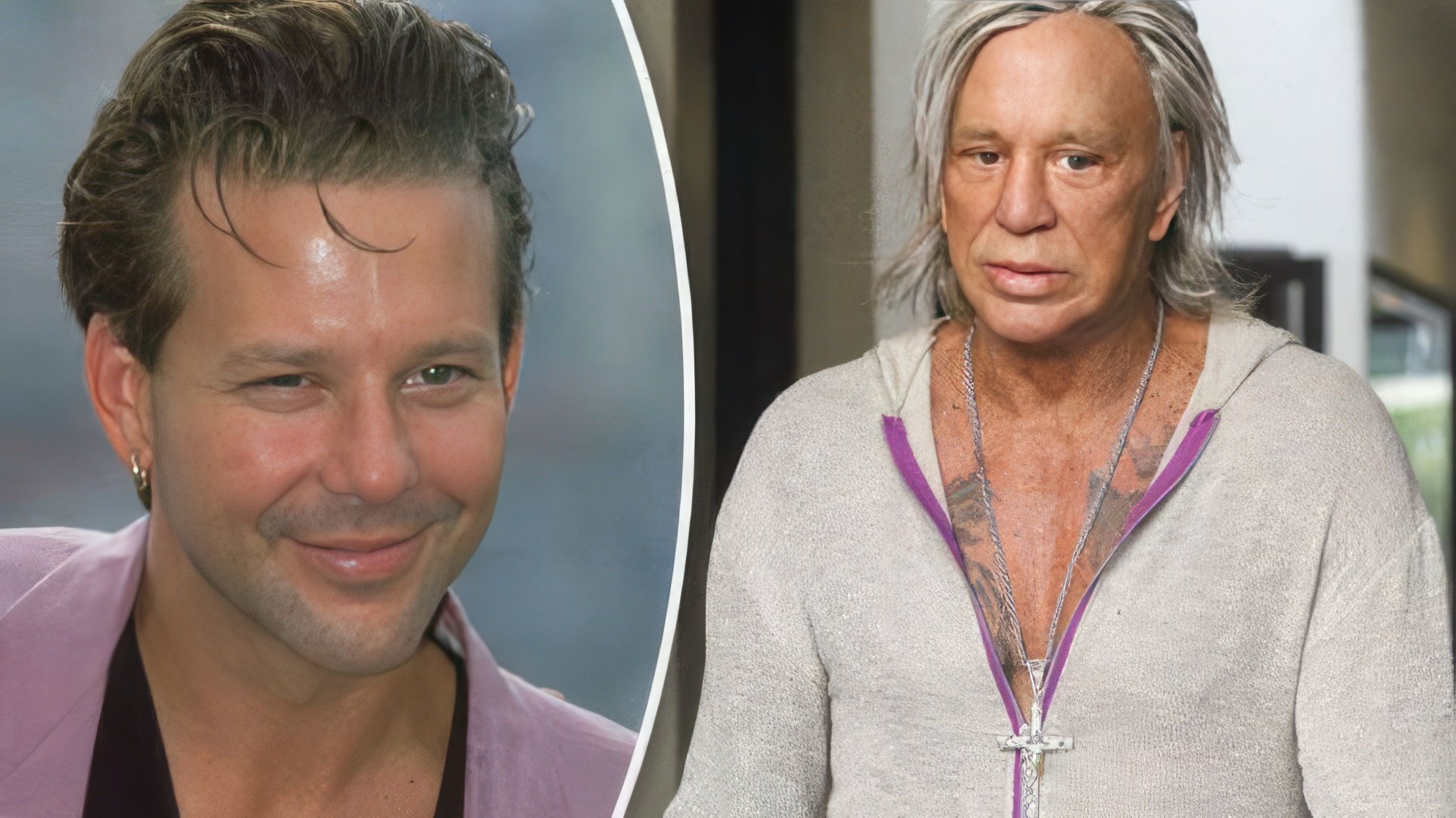 Mickey Rourke Prima e Dopo la Chirurgia Plastica
