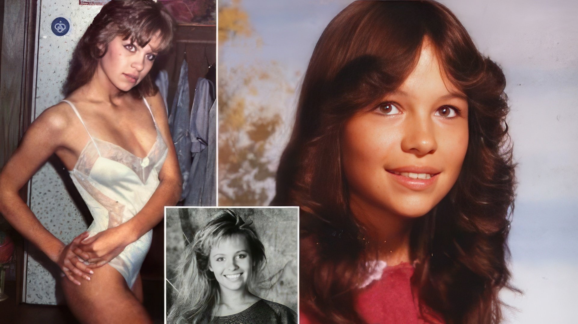 Pamela Anderson prima della chirurgia plastica