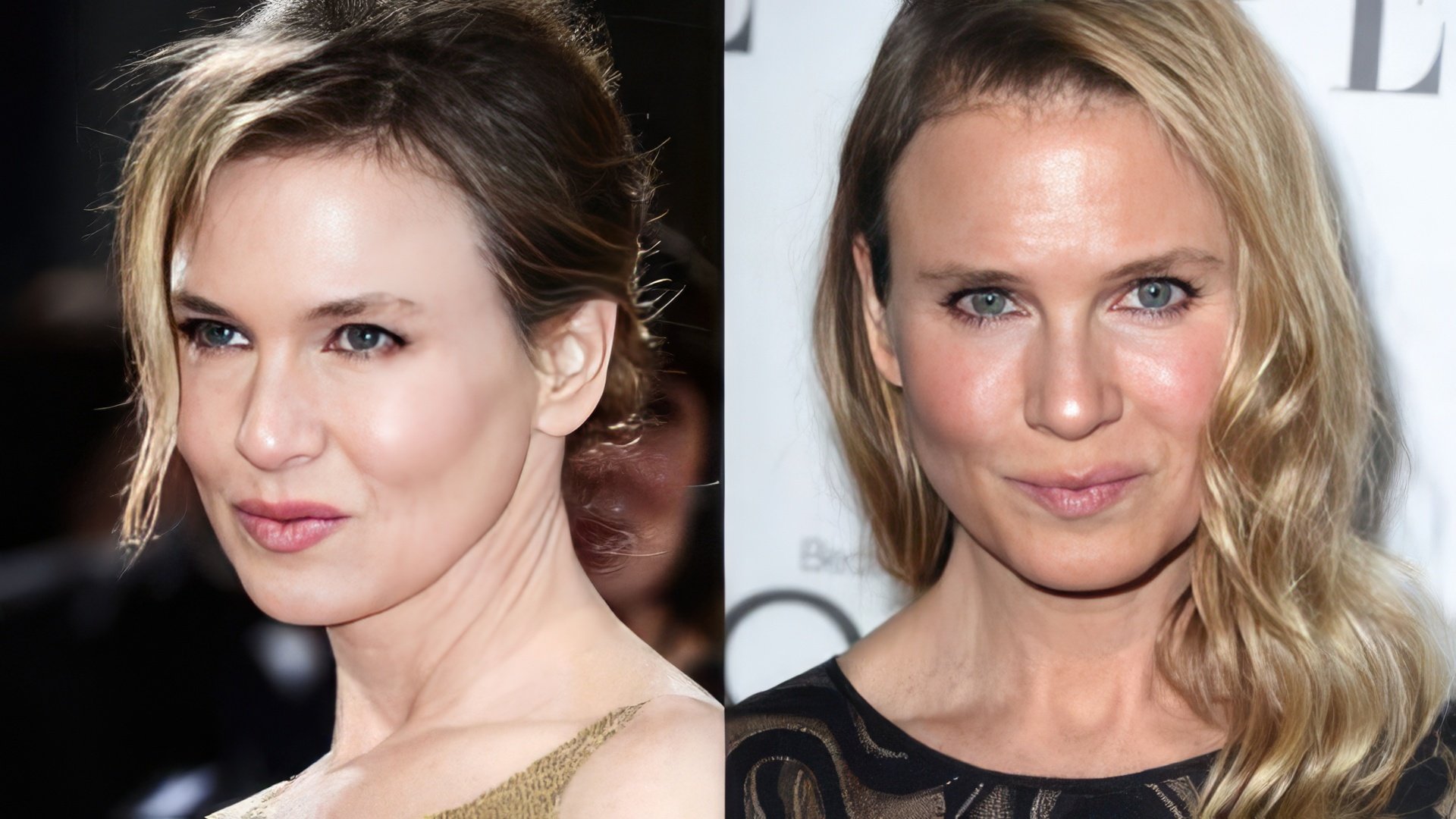 Renée Zellweger prima e dopo l'intervento chirurgico