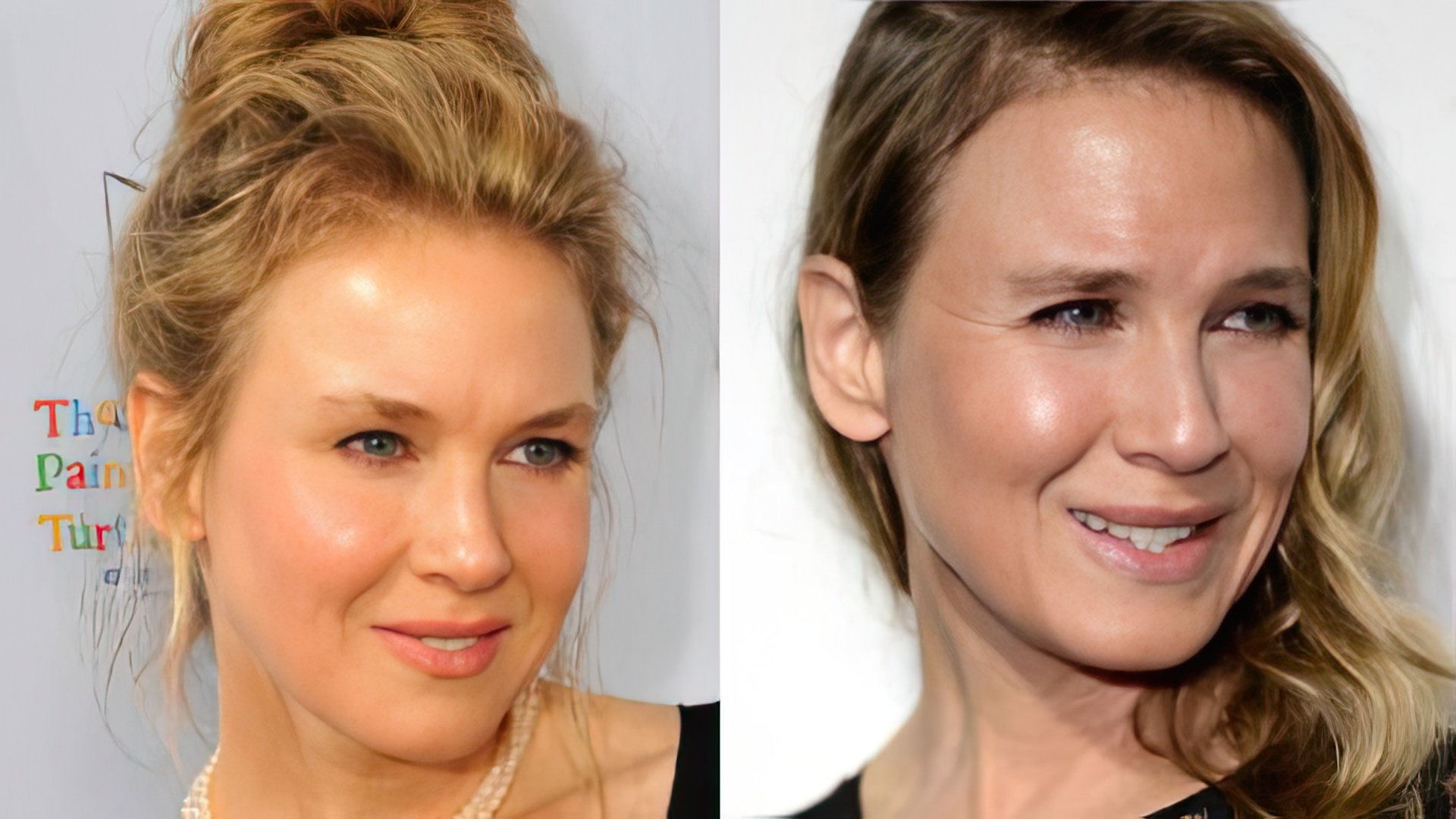 Molti credono che Renée Zellweger abbia rovinato il suo aspetto con la chirurgia.