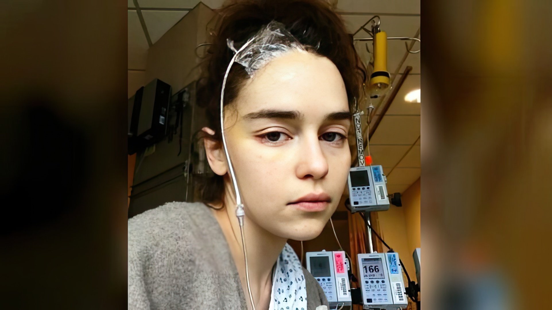 A causa di un aneurisma, Emilia Clarke ha subito tre operazioni