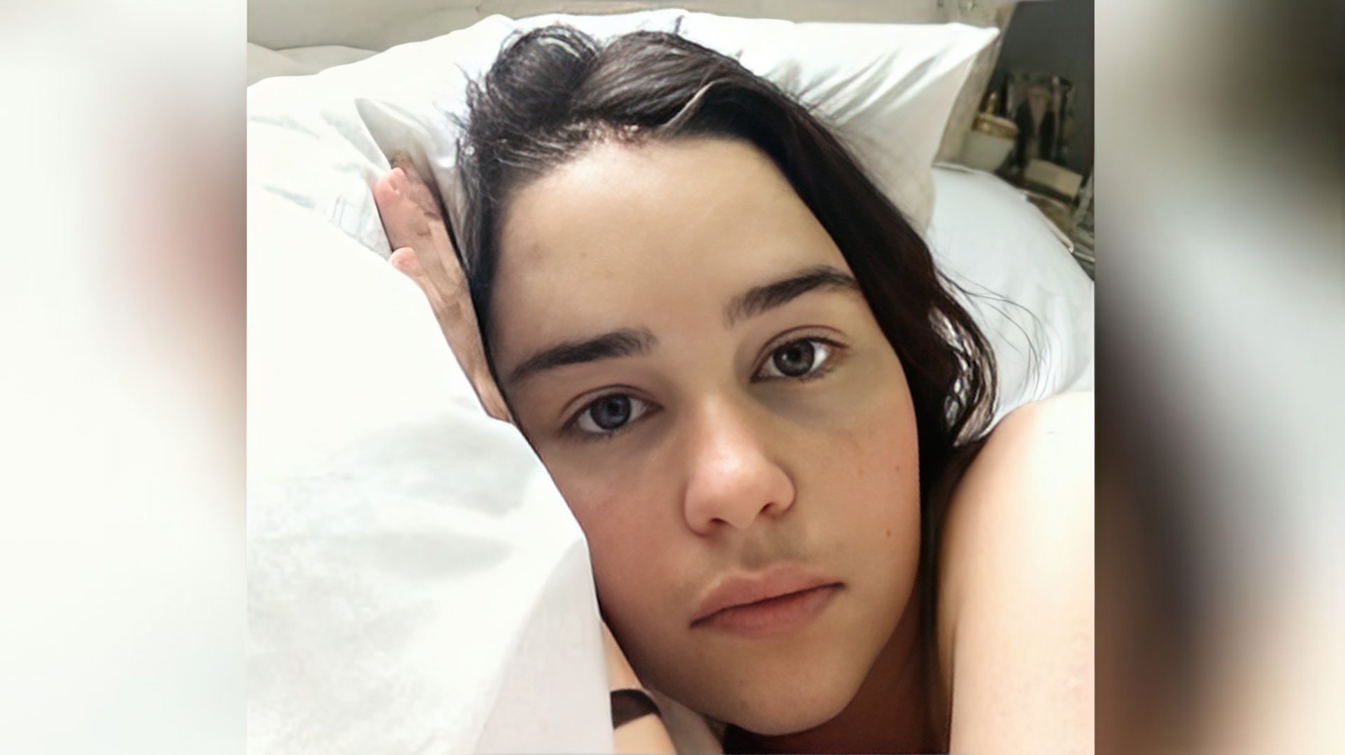 Emilia Clarke senza trucco