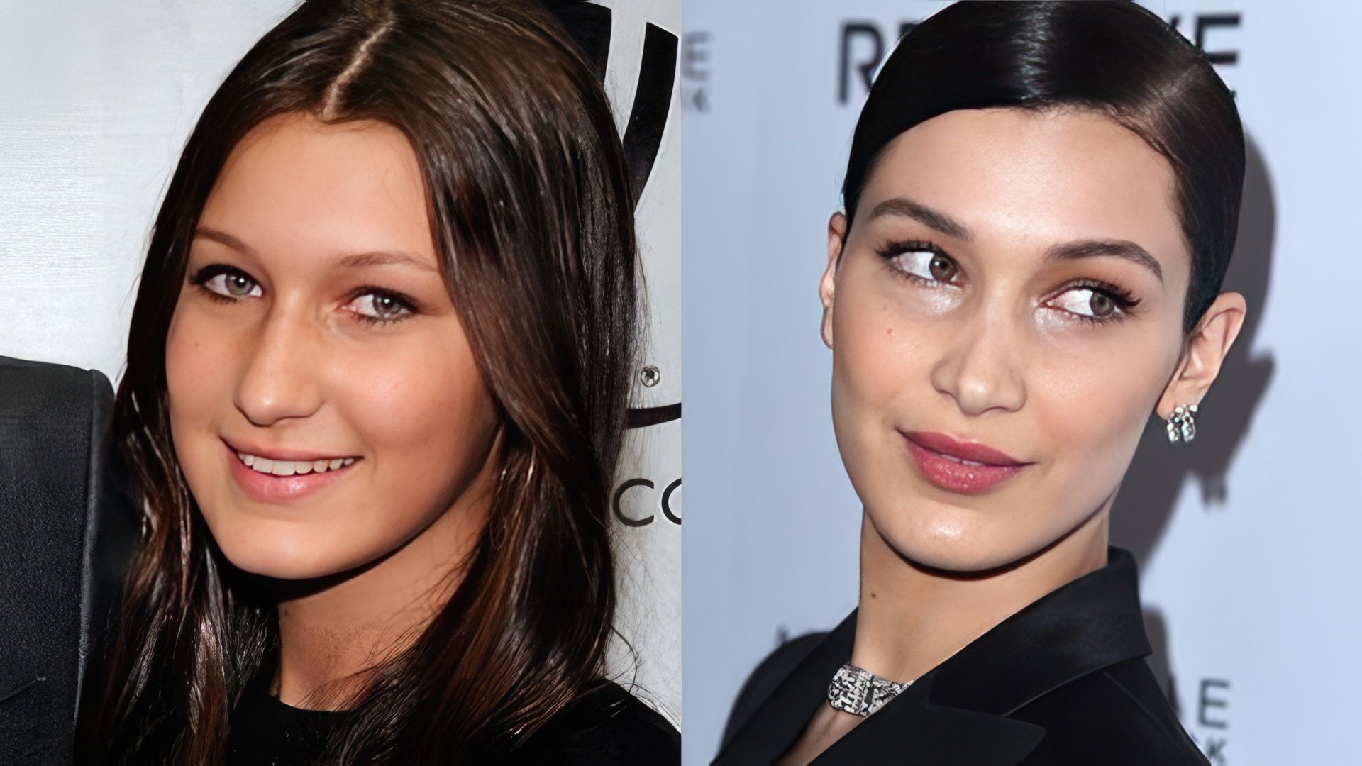 Bella Hadid prima e dopo la chirurgia estetica