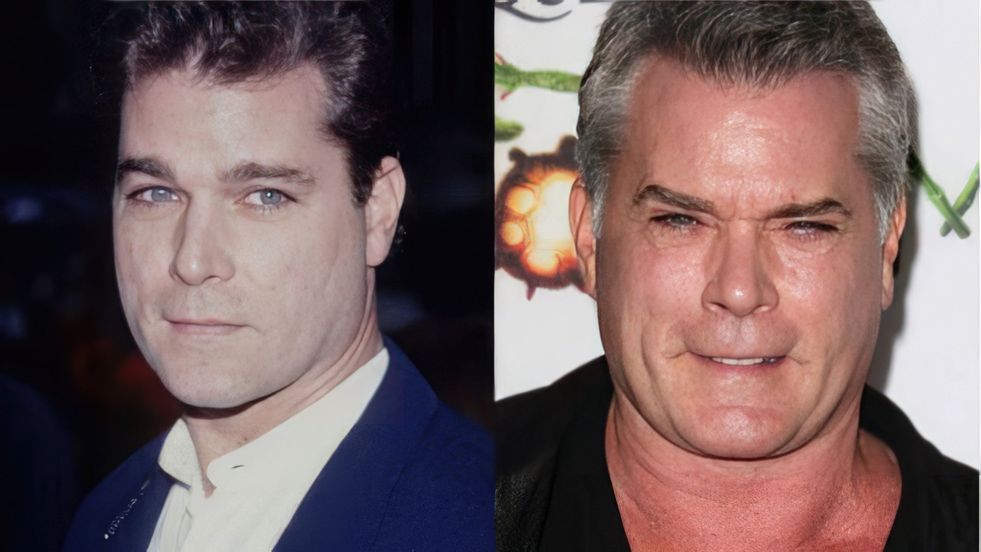 Ray Liotta prima e dopo la chirurgia plastica